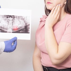 Wisdom teeth extraction