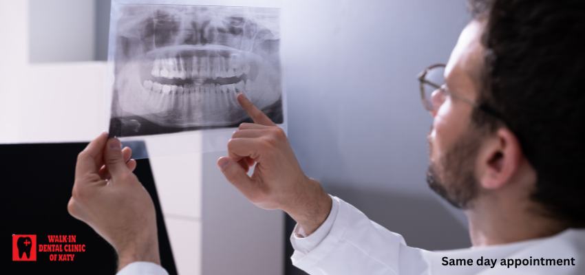 wisdom teeth wisdom teeth removal