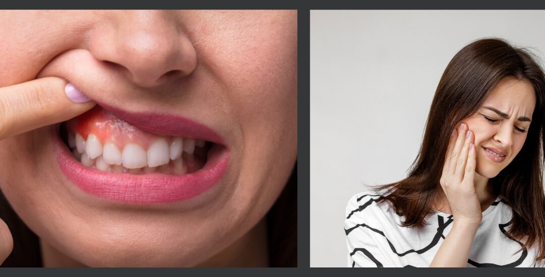 What to Do for a Toothache and Swelling Emergency: Quick Relief & When to See a Dentist