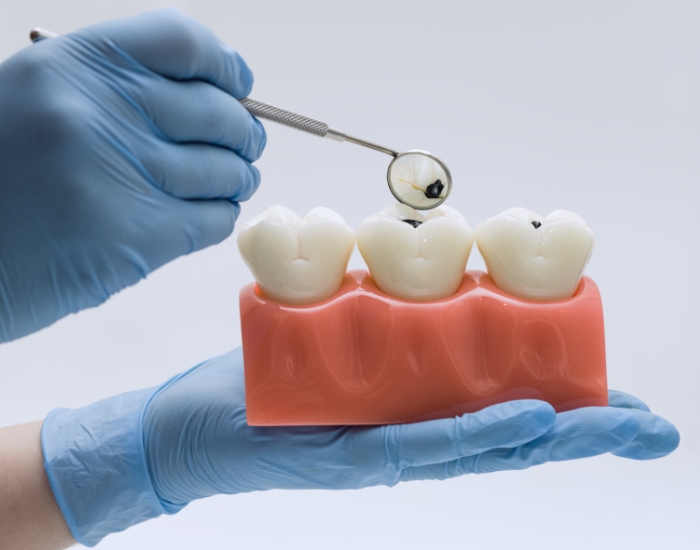 Understanding the First Permanent Molar Tooth: Function, Problems, and Treatment Options