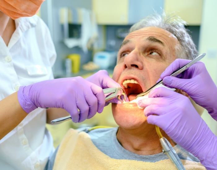 Severe Tooth Pain? Signs You Need Emergency Extraction