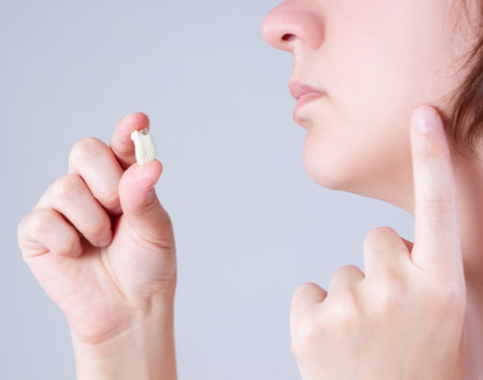 Wisdom Teeth Removal Cost Houston | Complete Guide