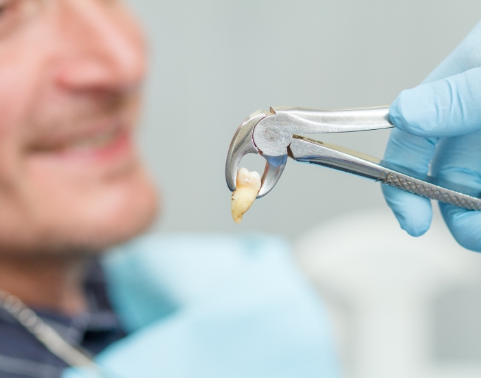 Bicuspid Premolar Tooth Extraction: Causes, Care & Recovery