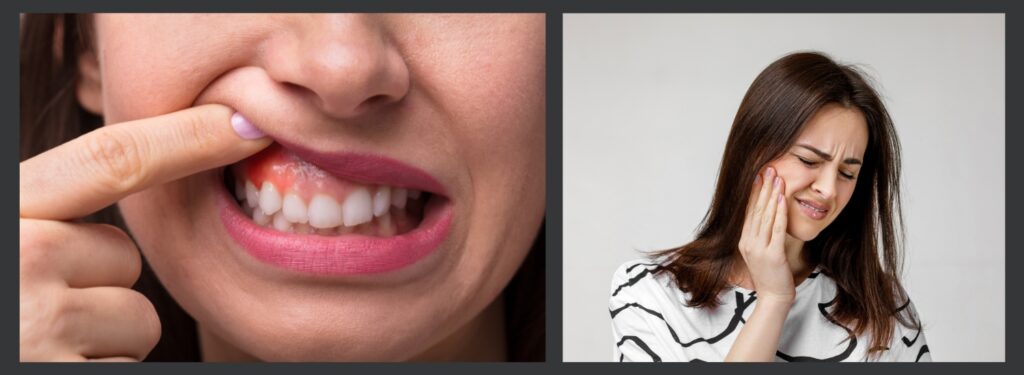 toothache and swelling emergency